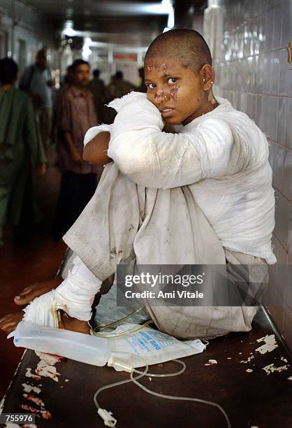 Afsana, who was burned in Hindu-Muslim riots, recuperates at a civil hospital March 5, 2002 in Ahmadabad, India. About 600 people have died in six...