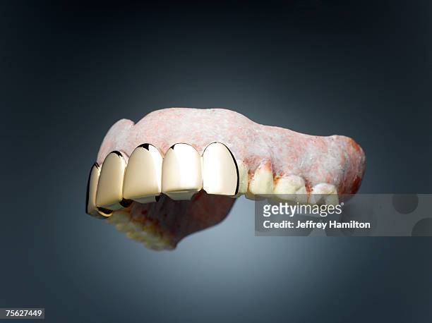 dentures with gold teeth in font - capped tooth stock-fotos und bilder