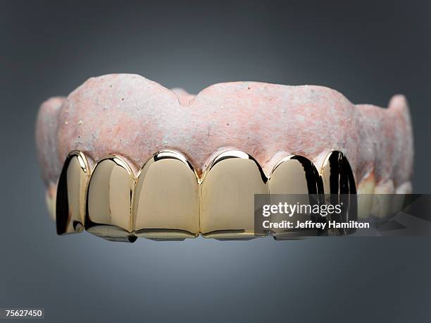 dentures with gold teeth in font - capped tooth stock-fotos und bilder