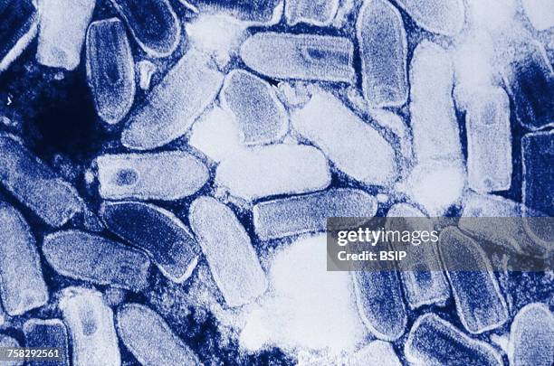 vesicular stomatitis virus - vesiculovirus stock pictures, royalty-free photos & images