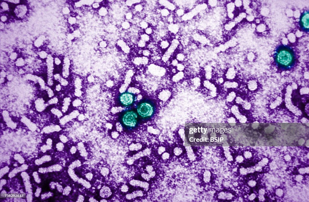 Hepatitis b virus