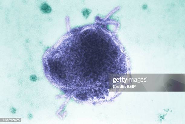 Morbil Morbillivirus Photos et images de collection - Getty Images