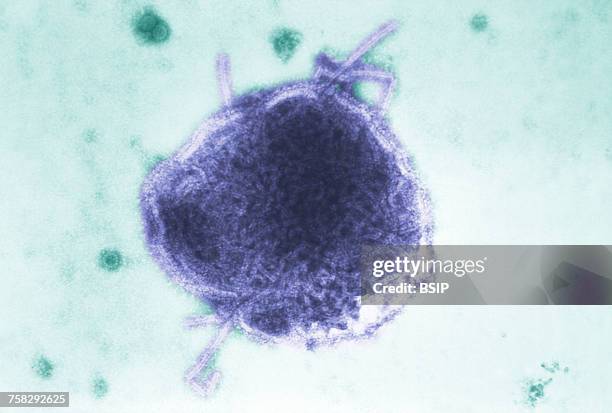 virus - morbillivirus 個照片及圖片檔