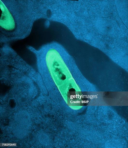 listeria - listeria monocytogenes stock pictures, royalty-free photos & images