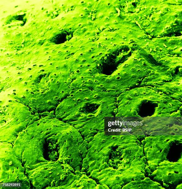 mucosa of the colon,sem - mucus stock pictures, royalty-free photos & images