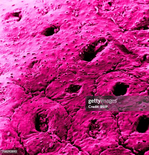 417 Human Tissue Texture Stock Photos, High-Res Pictures, and Images ...