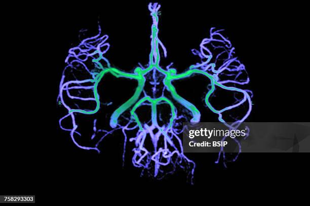 williss circle - círculo de willis - fotografias e filmes do acervo
