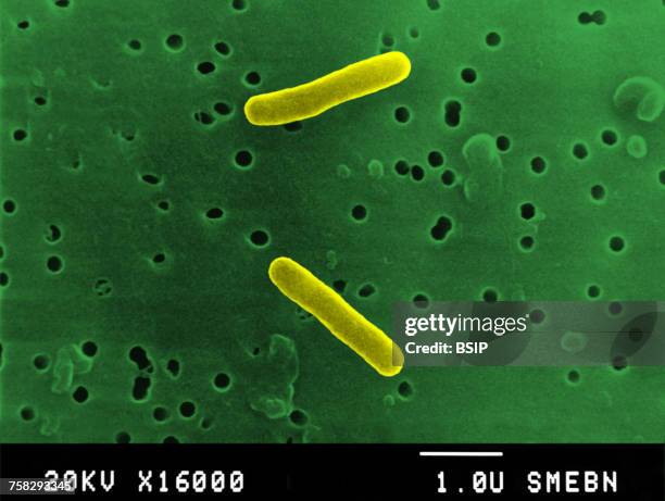 salmonella typhimurium - salmonella bacteria stock-fotos und bilder