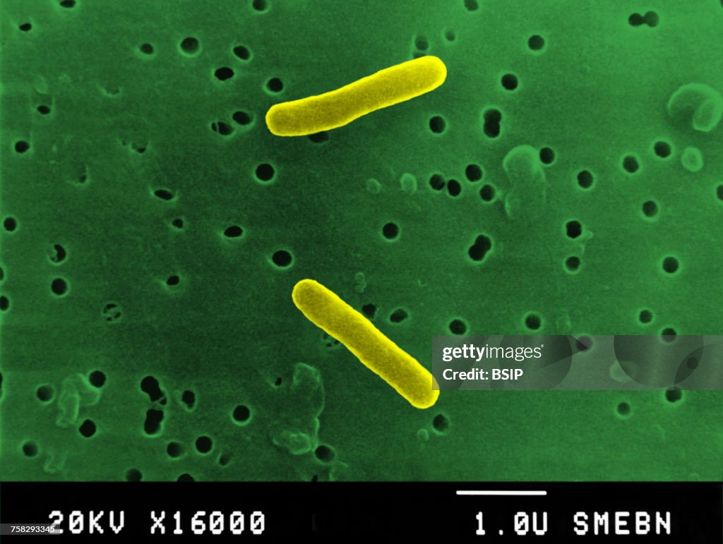 Salmonella typhimurium