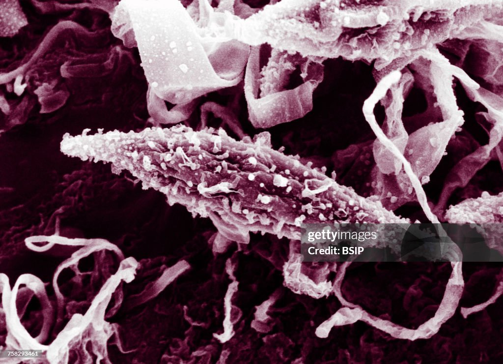 Microsporum canis