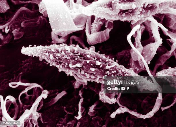 microsporum canis - dermatophyte - fotografias e filmes do acervo