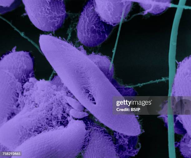paramoecium sem - micrografía electrónica escaneadora fotografías e imágenes de stock