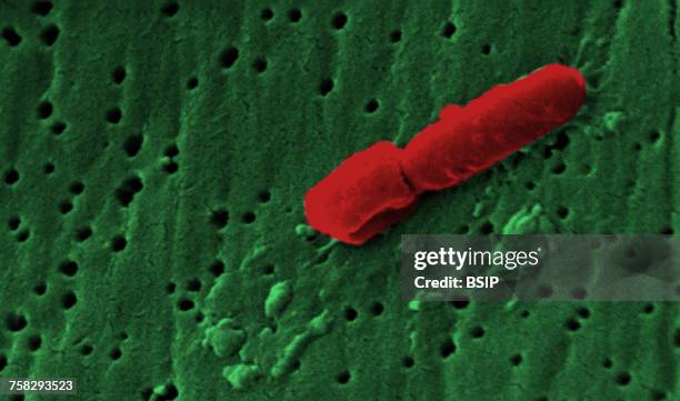 klebsiella pneumoniae - klebsiella pneumoniae stock pictures, royalty-free photos & images