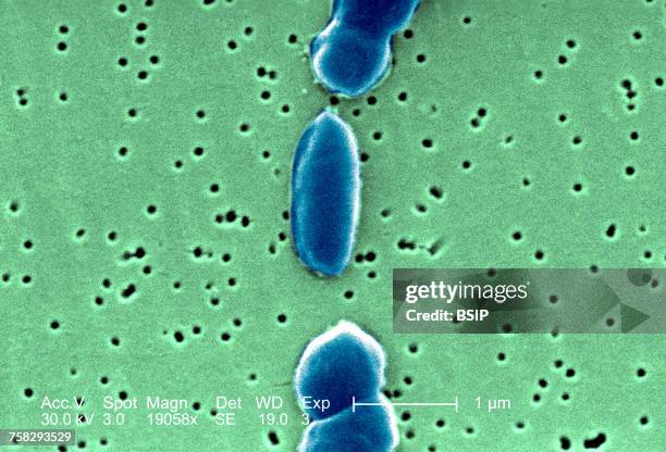 vibrio parahaemolyticus - vibrio parahaemolyticus fotografías e imágenes de stock