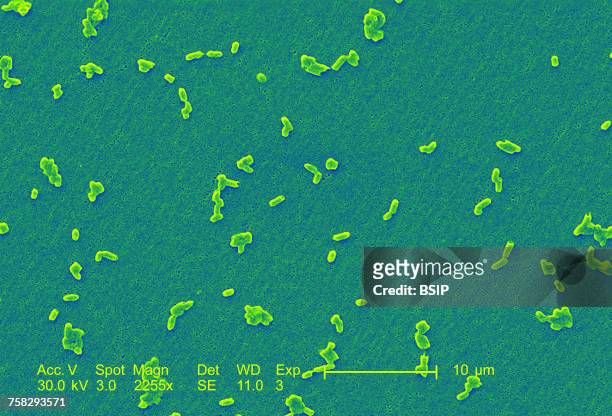 salmonella infantis - salmonella bacteria stock-fotos und bilder