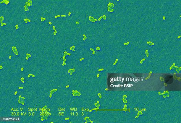 salmonella infantis - salmonella bacterium stockfoto's en -beelden