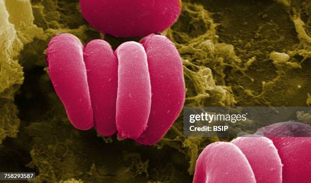 red blood cell & fibrin,sem - fibrin stock pictures, royalty-free photos & images