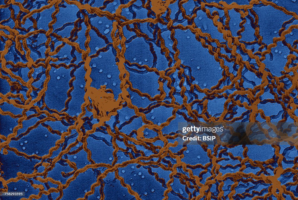 Leptospira,sem