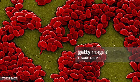 Anthrax bacterium spore,sem Anthrax bacterium spore,sem