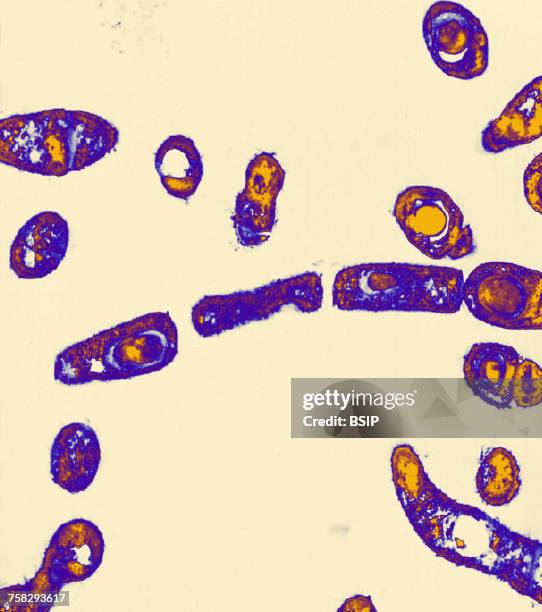 Spore Tem Spore Microscope Photos and Premium High Res Pictures - Getty Images