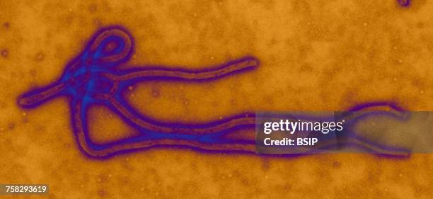 ebola virus,tem - hemorragische koorts stockfoto's en -beelden