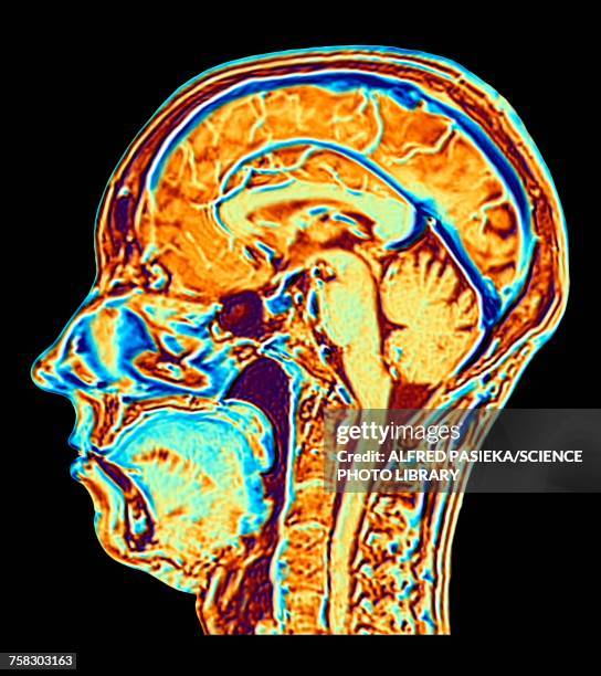 mri scan of normal brain, illustration - wissenschaftliche bildtechnik stock-fotos und bilder