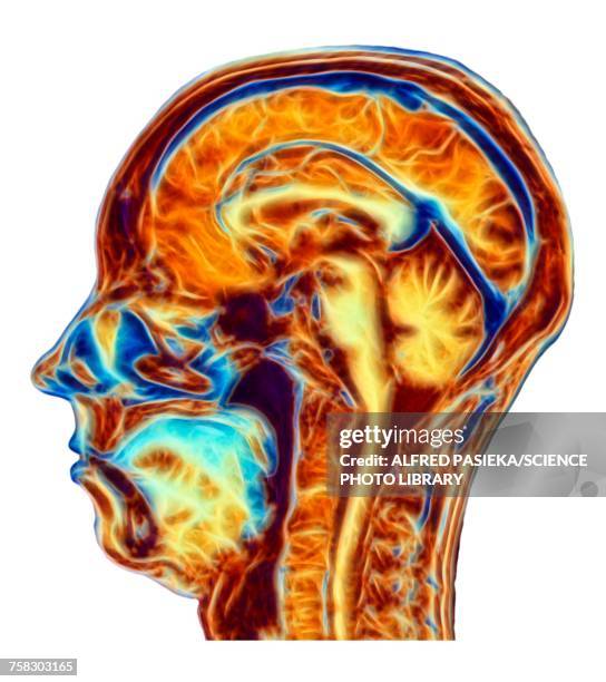 Visualized Brain Normal Normal Brain Scan Photos and Premium High Res Pictures - Getty Images