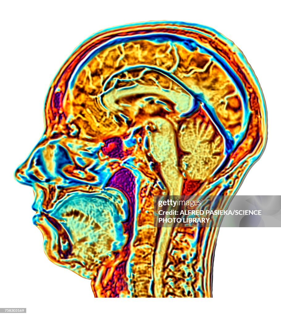Normal Brain Pattern Illustration Showing Anatomy Of A Normal Brain In A