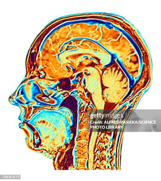 Visualized Brain Normal 95 Normal Brain Scan Stock Photos, High-Res Pictures, and Images ...