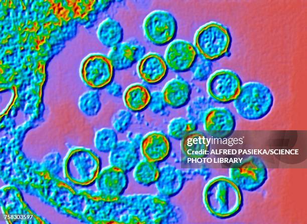 hantavirus particles, tem - hantavirus stock illustrations