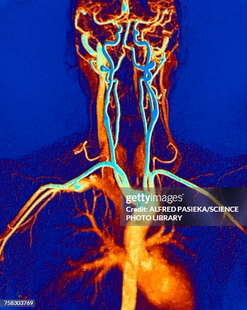 chest, neck and head arteries, mri scan - tomography stock illustrations