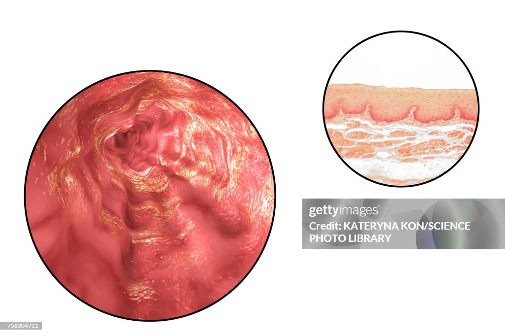 Oesophagus wall, light micrograph and illustration