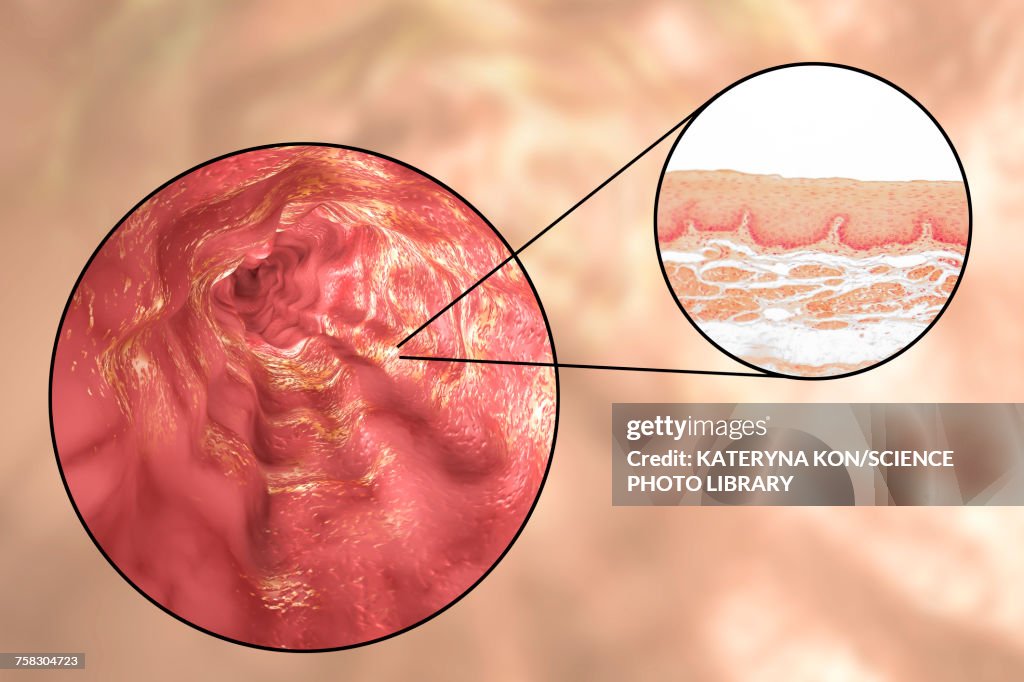 Oesophagus wall, light micrograph and illustration