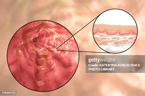 oesophagus wall, light micrograph and illustration - lamina propria stock-grafiken, -clipart, -cartoons und -symbole