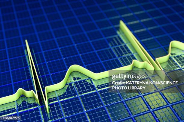 ecg, illustration - conduction stock illustrations