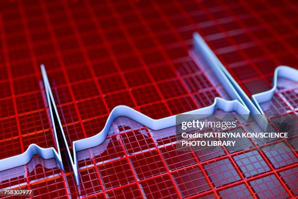 ecg, illustration - conduction stock illustrations