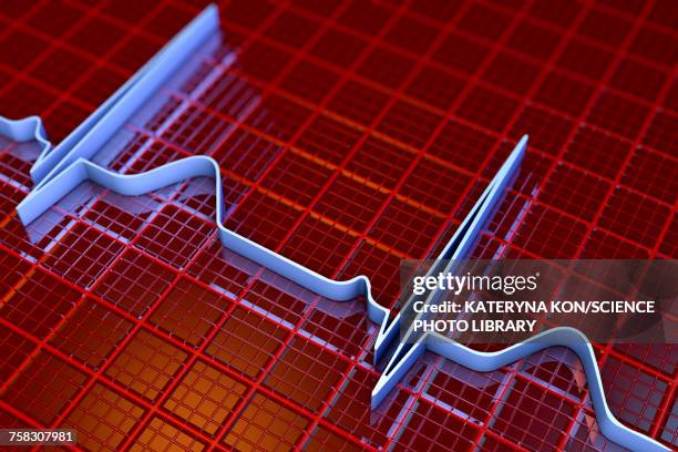 ecg, illustration - conduction stock illustrations