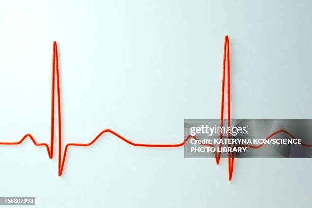 ilustrações de stock, clip art, desenhos animados e ícones de ecg, illustration - electrocardiography