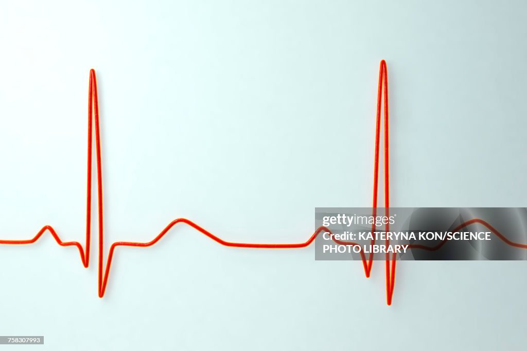 ECG, illustration
