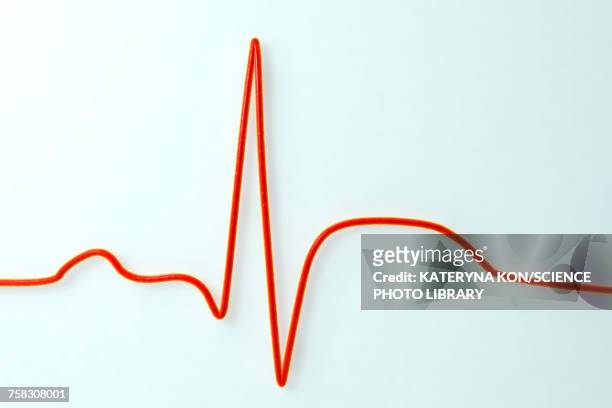 stockillustraties, clipart, cartoons en iconen met ecg in myocardial infarction, illustration - angina