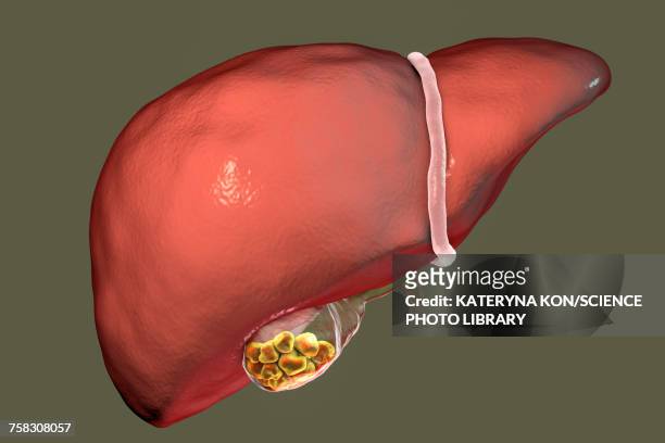 gallstones, illustration - human liver stock illustrations