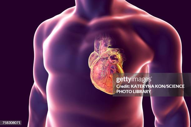 heart attack, conceptual illustration - human heart stock illustrations