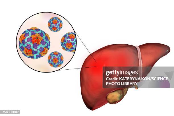 ilustrações, clipart, desenhos animados e ícones de hepatitis a, illustration - hav