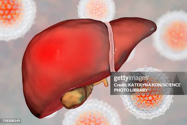 bildbanksillustrationer, clip art samt tecknat material och ikoner med hepatitis c, illustration - hepatitis virus