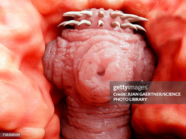 tapeworm head attached to intestine, illustration - tapeworm stock illustrations