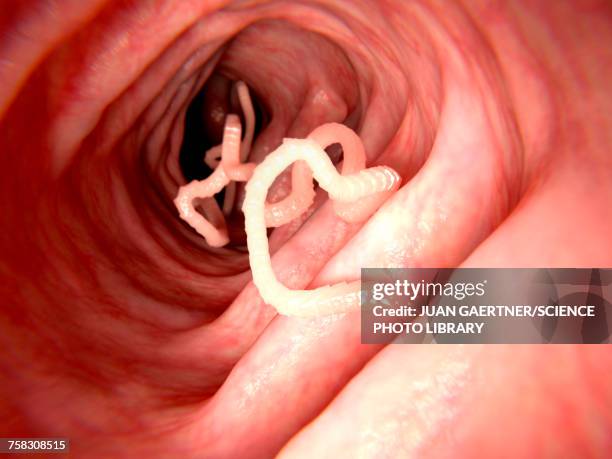 255 Human Tapeworm Stock Photos High Res Pictures And Images Getty 255-human-tapeworm-stock-photos-high-res-pictures-and-images-getty