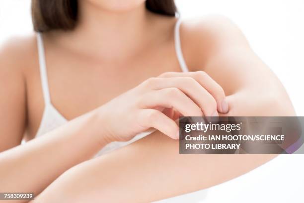 woman scratching arm - juckreiz stock-fotos und bilder