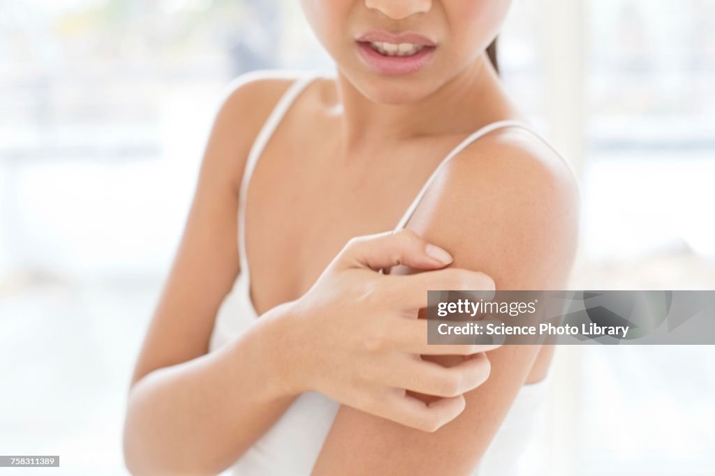 Woman scratching shoulder