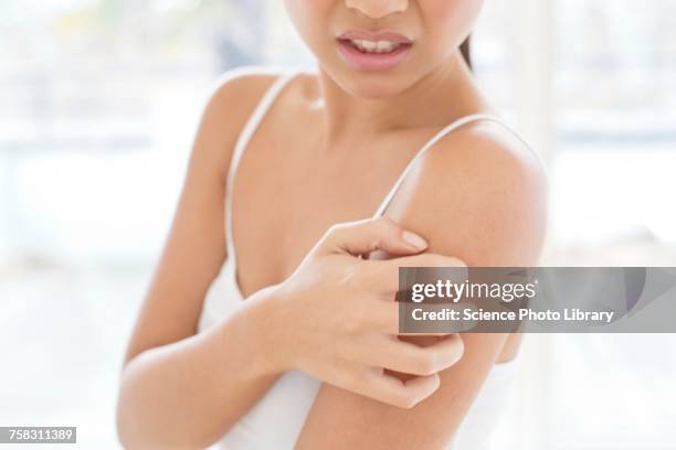 woman scratching shoulder - picor fotografías e imágenes de stock