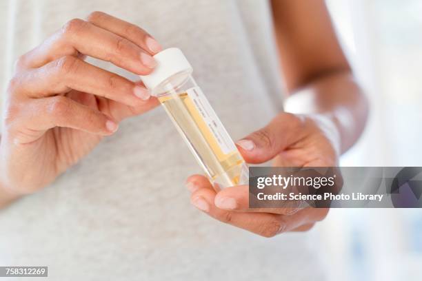 woman holding urine sample - urine sample ストックフォトと画像